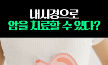 수술 없이 내시경으로만 위,대장암 치료를?